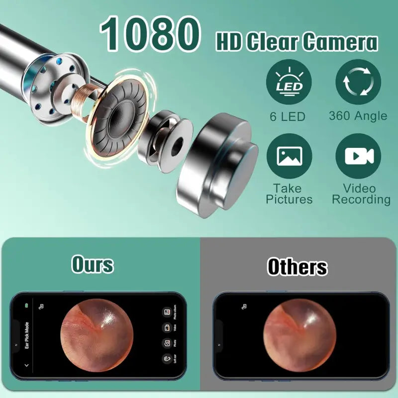 The Ultimate Wireless HD Ear Cleaner (11-Piece)